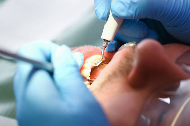 Best Pediatric Emergency Dentist in Choctaw, OK