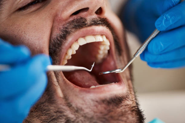 Best Same-Day Emergency Dental Services in Choctaw, OK