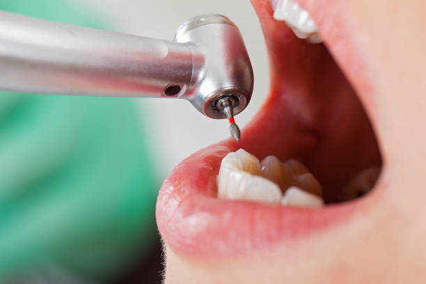 Best After-Hours Dental Trauma Care in Choctaw, OK